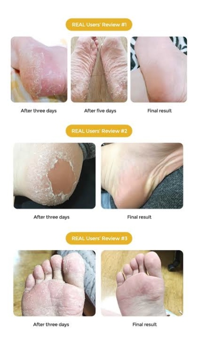 Purederm, Exfoliating Foot Mask Regular 1 pair